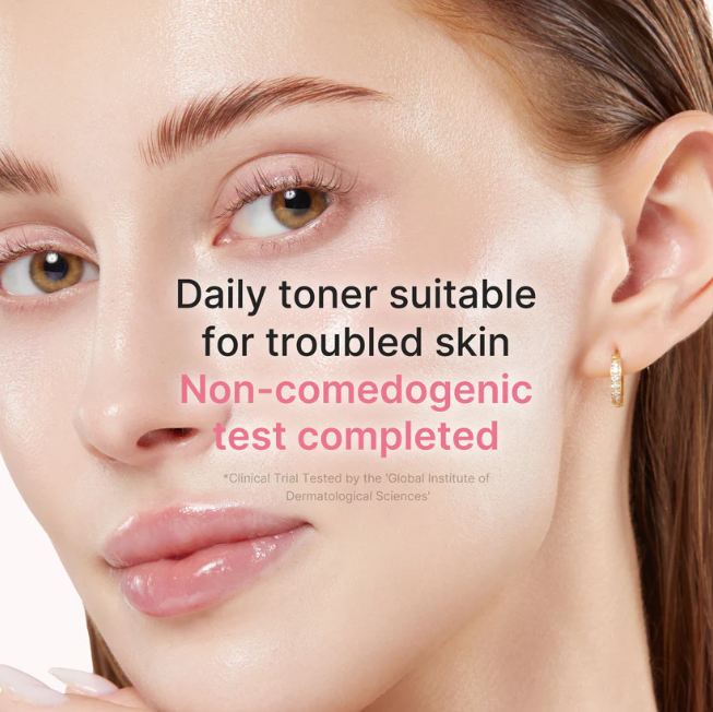 PDRN Pink Niacinamide Milky Toner - non-comedogenic daily toner for troubled skin